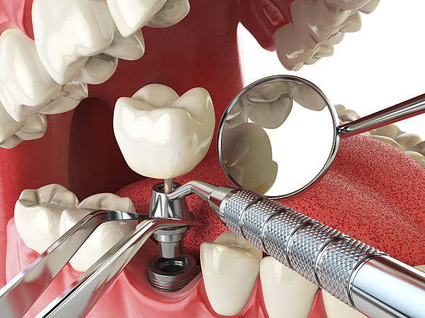 Best Emergency Dental Services for Seniors in Mount Arlington, NJ
