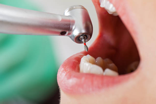Best Emergency Dentist for Knocked-Out Tooth in Mount Arlington, NJ
